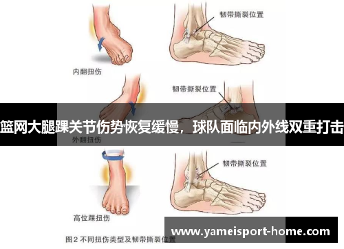 篮网大腿踝关节伤势恢复缓慢，球队面临内外线双重打击